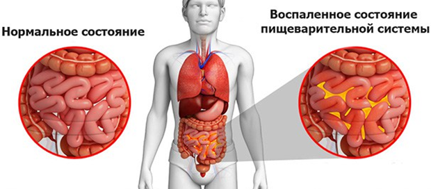 Боли внизу живота у мужчин: причины и лечение