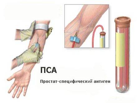 Анализы крови пса расшифровка и нормальные показатели