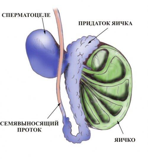 Шишечки на мошонке