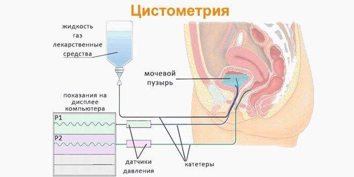 Цистометрия