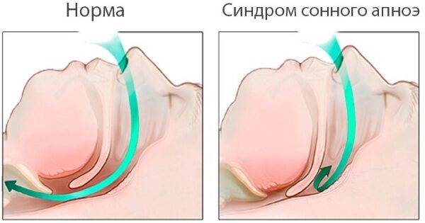 Почему так часто хочется писать? Как лечить частое мочеиспускание у женщин?