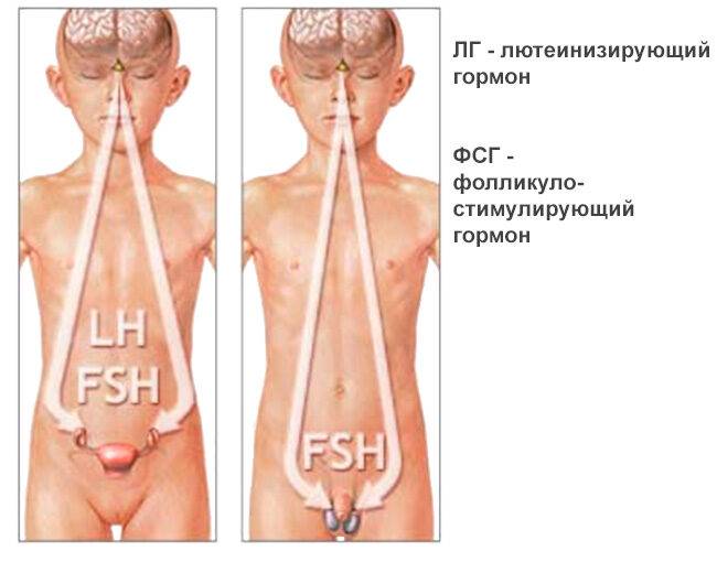 Гипогонадизм у мальчиков