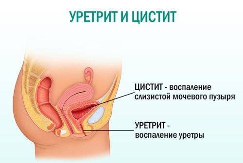 Почему моча зеленого цвета: причины и возможные заболевания