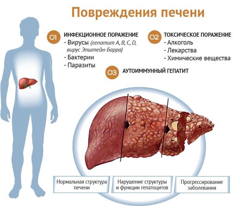 ᐉ Фурагин при цистите как принимать взрослым