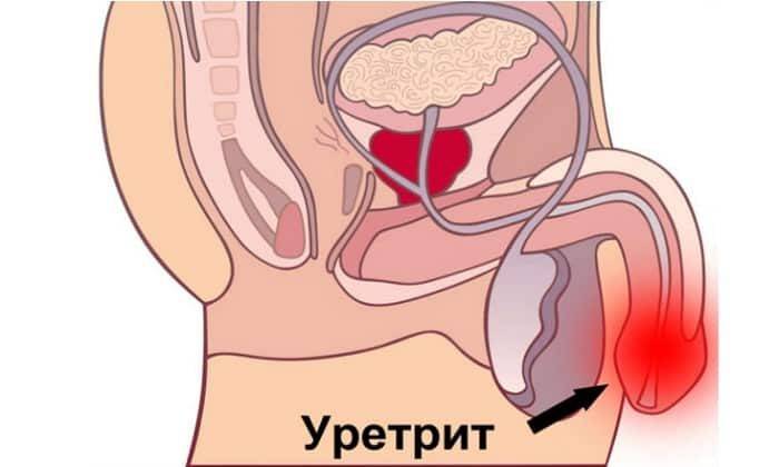 При уретрите принято принимать Ломфлокс