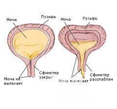 Никтурия симптомы и лечение