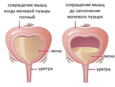 Болит мочевой пузырь - причины у мужчины и женщины, симптомы, чем лечить