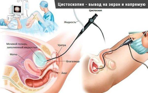 Как проверить мочевой пузырь у женщин и мужчин