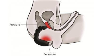 Массаж простаты дома мужу пальцем для удовольствия: видео для жен?