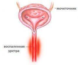 Частое мочеиспускание у мужчин – нельзя пропустить эти симптомы