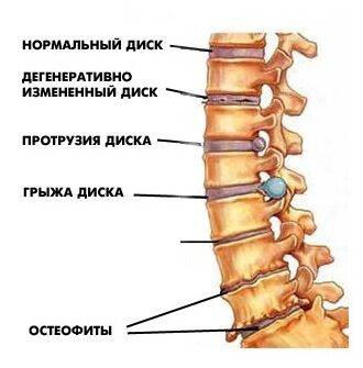 Мочевой пузырь не опорожняется полностью у женщин и мужчин: причины, лечение