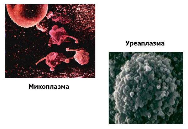 Уреаплазмоз у мужчин: пути заражения, симптомы и схема лечения.