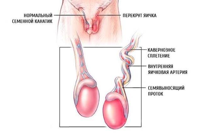 Почему болит правое яичко у мужчины