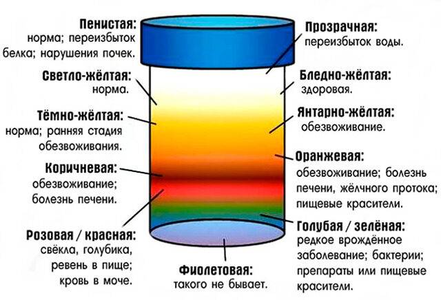 Оранжевая моча - причины и диагностика изменения цвета