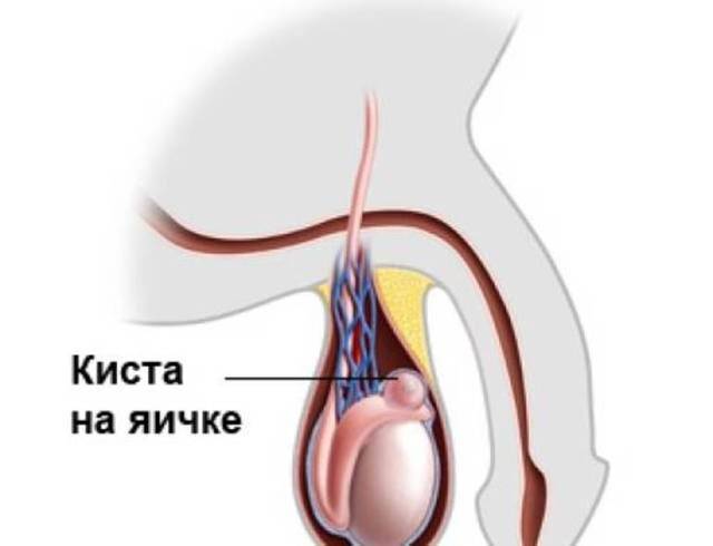 Почему болит правое яичко у мужчины