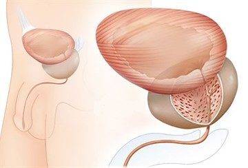 Размер аденомы простаты норма