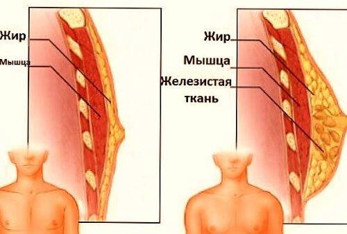 Болит правый сосочек у мужчины при нажатии. Почему болят и чешутся соски у мужчин