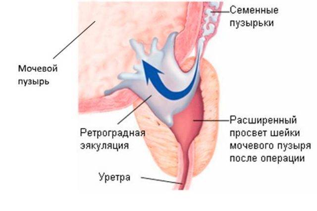 Плохая спермограмма: 9 причин отклонений анализа у мужчин, что делать