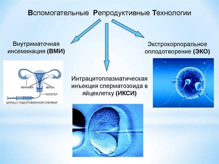 вспомогательные репродуктивные технологии