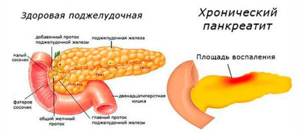 Эхоструктура паренхимы диффузно неоднородная