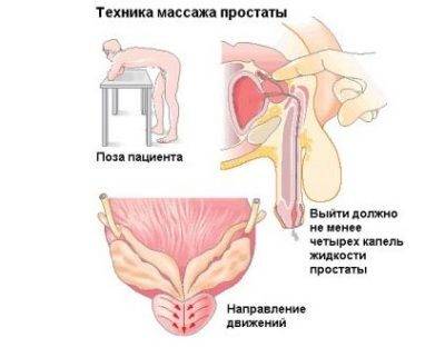 Массаж простаты дома мужу для кайфа пальцем и прибором: как правильно делать