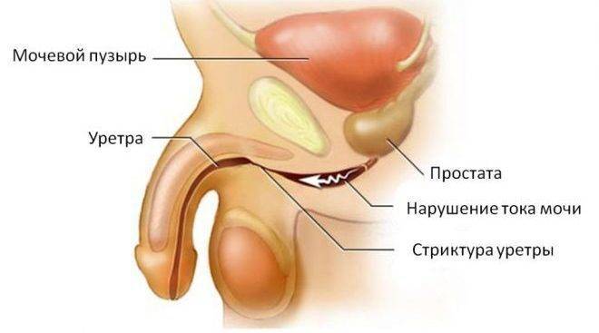 Мазок из уретры у мужчин