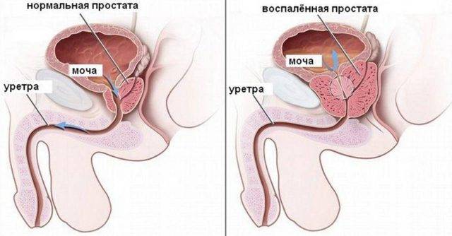 Густая сперма комками