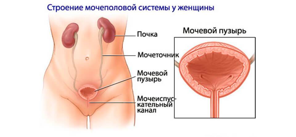 Уретрит у женщин