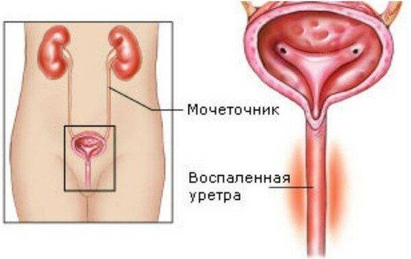 Слизь в моче у ребенка: причины, что означает наличие белка у грудничков