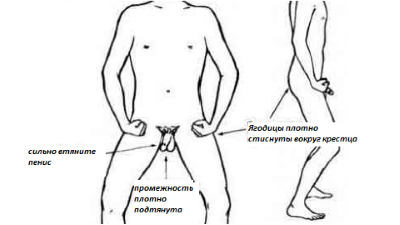 Физические упражнения при хроническом простатите — Сайт о простатите