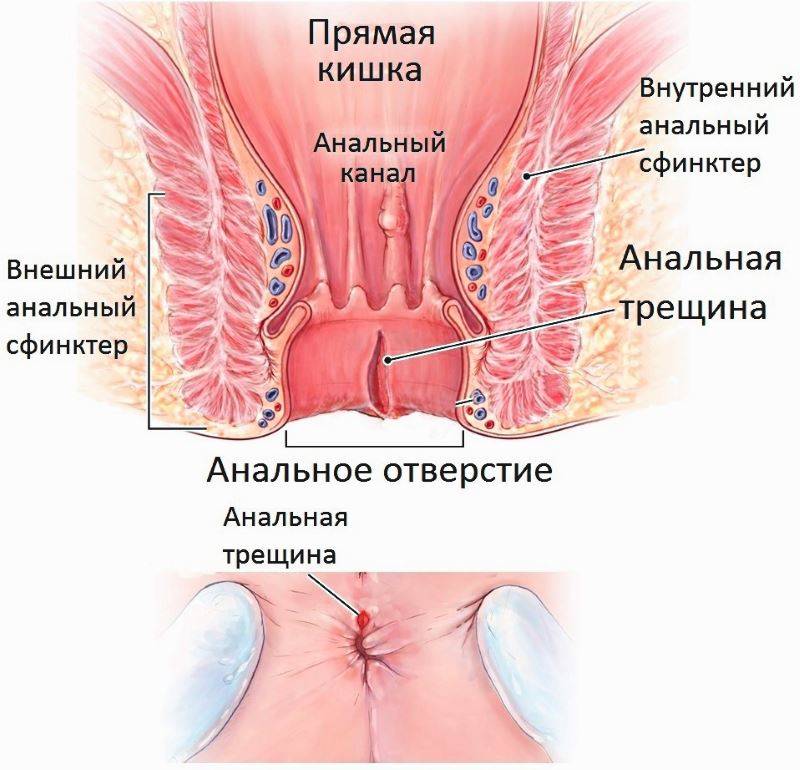 Антибактериальные свечи для мужчин