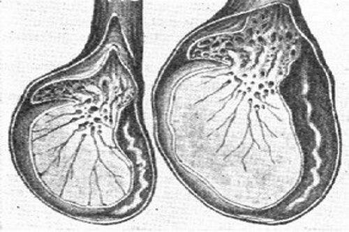 Боль в яичках у мужчин: причины мужских болезней яичек