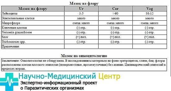 Анализ на флору у женщин: подготовка, процедура и расшифровка мазка