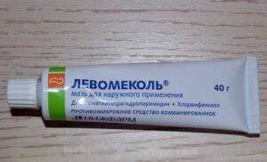 Скопление смегмы под крайней плотью у детей: причины, отличие от патологических выделений, лечение