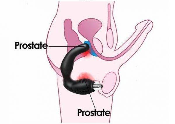 Массаж простаты дома мужу пальцем для удовольствия: видео для жен?