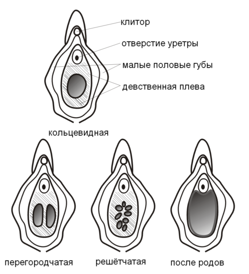 кровь после секса