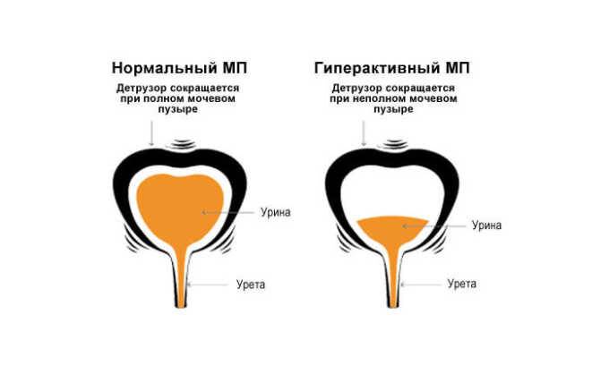 Причиной появления жалоб может стать нарушение иннервации органа