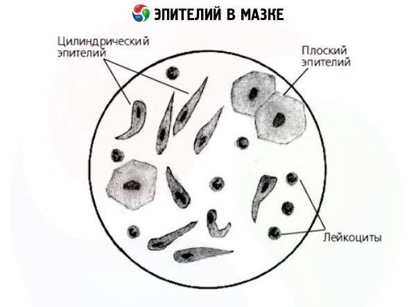 Уретра плоский эпителий норма