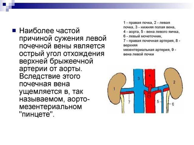 Варикоцеле: причины, признаки, постановка диагноза и методы лечения болезни у мужчин