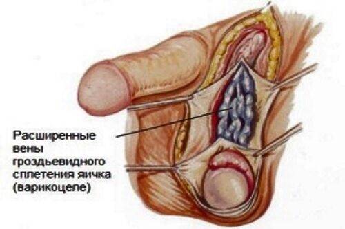 Боль в яичках у мужчин: причины мужских болезней яичек