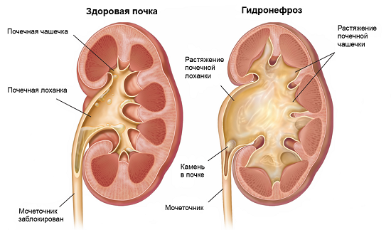 какие причины?