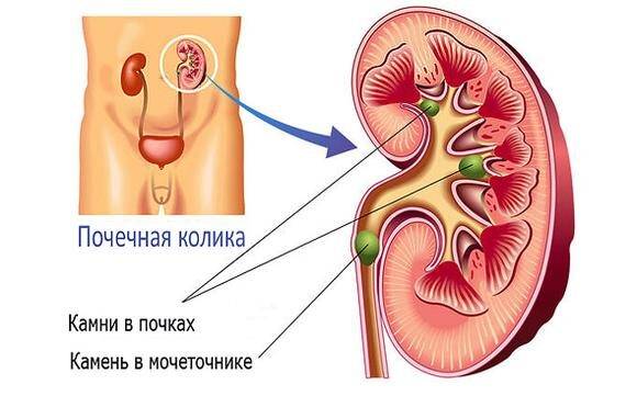 Чем можно лечить почки