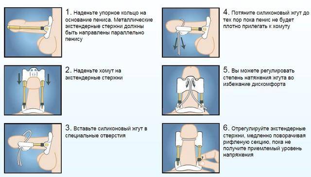 Как правильно зафиксировать экстендер