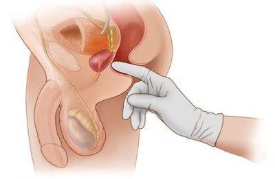 Наружный массаж простаты: как делать и есть ли польза