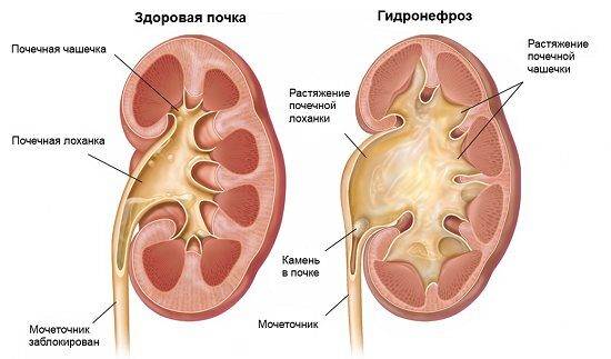 какие причины?