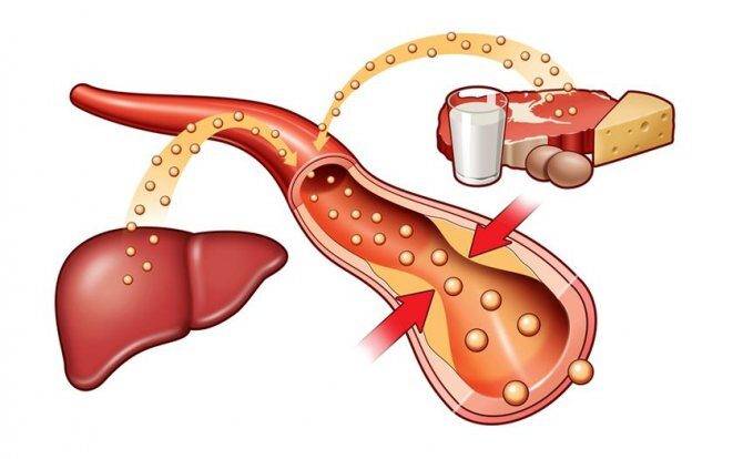 В каких продуктах содержится вредный холестерин. Продукты повышающие холестерин