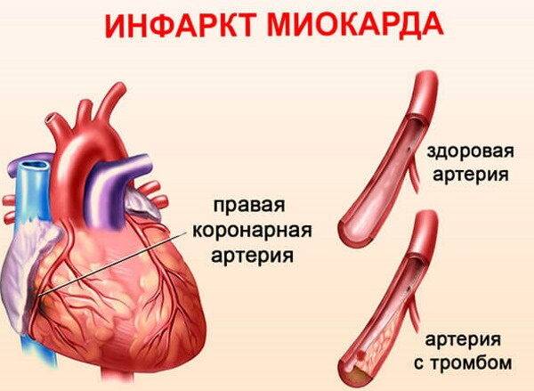 Милдронат. Инструкция по применению, отзывы пациентов, цена, аналоги