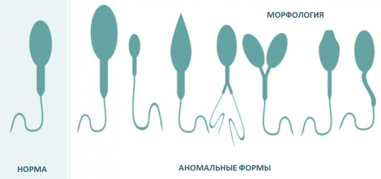 Сочетанная патология в спермограмме что это