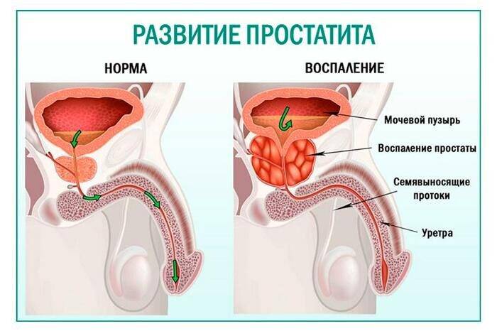 Настойка бобровой струи. Полезные свойства, приготовление, применение, от каких болезней