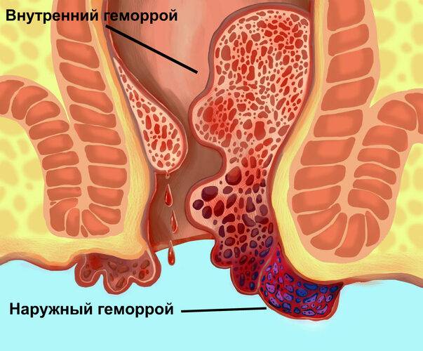 Настойка бобровой струи. Полезные свойства, приготовление, применение, от каких болезней